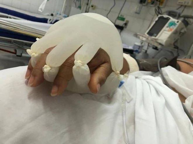 “Το χέρι του Θεού”: Νοσοκόμες στη Βραζιλία παρηγορούν τους ασθενείς με Covid-19 με συγκινητικό τρόπο