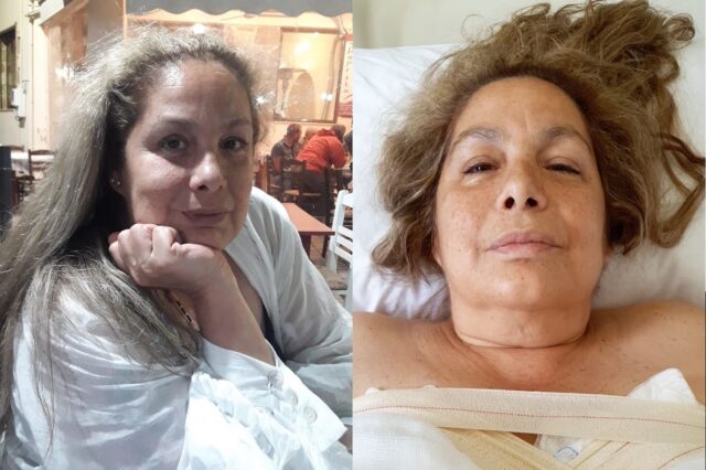 Τζένη Χειλουδάκη: Οι πρώτες φωτογραφίες μετά το σοβαρό χειρουργείο