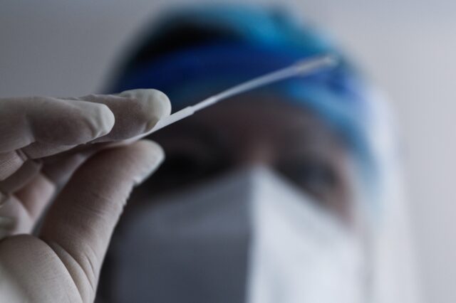 ΕΟΔΥ: Πού θα γίνονται την Πέμπτη δωρεάν rapid test