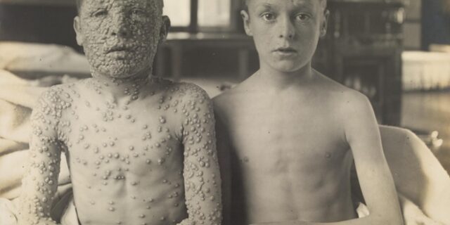 Η φωτογραφία που πρέπει να δει κάθε αντιεμβολιαστής – Η ήττα μιας πανδημίας