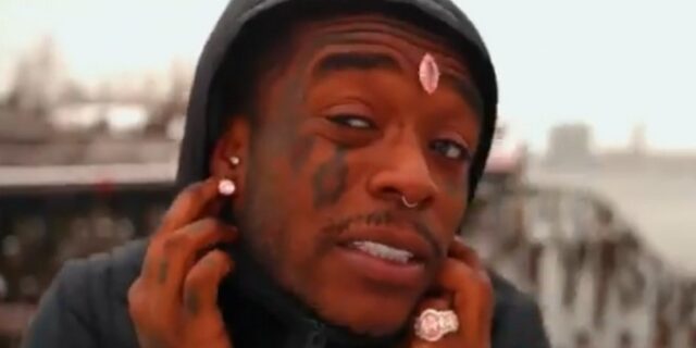 Lil Uzi Vert: Έχασε το διαμάντι των 24 εκατ. δολαρίων που είχε εμφυτεύσει στο μέτωπό του