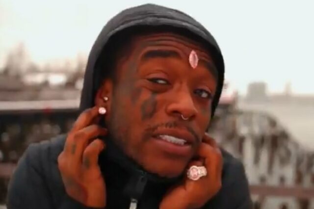 Lil Uzi Vert: Έχασε το διαμάντι των 24 εκατ. δολαρίων που είχε εμφυτεύσει στο μέτωπό του