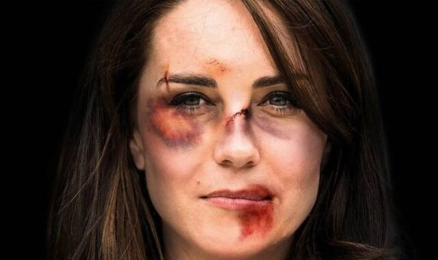 Κέιτ Μίντλετον – Καμάλα Χάρις με πληγές και μώλωπες: Συγκλονιστική καμπάνια κατά της βίας σε γυναίκες
