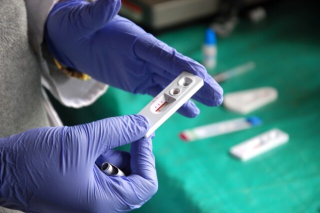 HIV: Δεύτερος ασθενής απαλλάχτηκε από τον ιό χωρίς μεταμόσχευση βλαστοκυττάρων