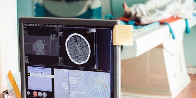 #Timetoact: 1.000.000 Ευρωπαίοι ενδεχομένως ζουν με καρκίνο που δεν ξέρουν πως έχουν