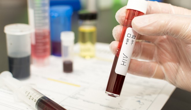 HIV: Ενθαρρυντικά αποτελέσματα από το νέο mRNA εμβόλιο