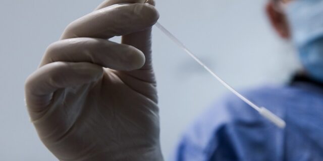 ΕΟΔΥ: Πού θα γίνονται δωρεάν rapid test την Τετάρτη (08/12)
