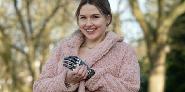 Gina Rühl: Η “πριγκίπισσα με το ένα χέρι”, που πάει για Μις Γερμανία