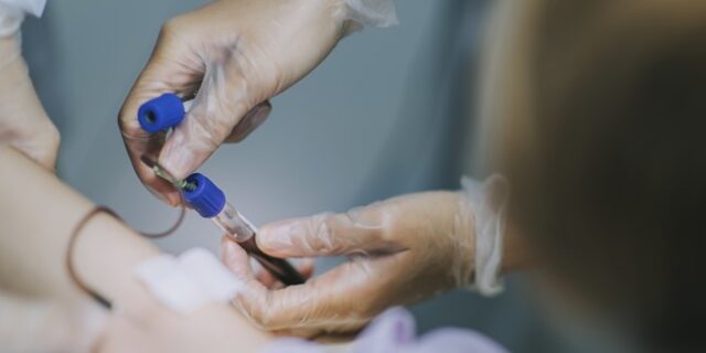 Νέο τεστ αίματος ανιχνεύει τον καρκίνο σε ανθρώπους με ακαθόριστα συμπτώματα