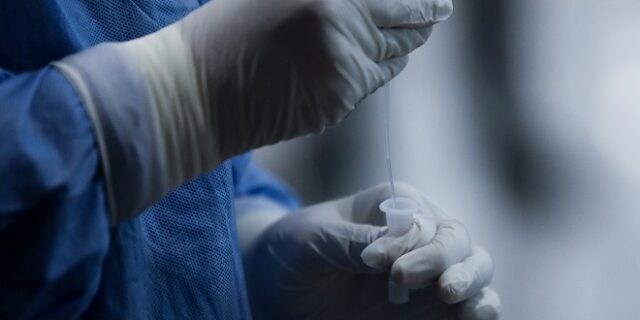 ΕΟΔΥ: Πού θα γίνονται δωρεάν rapid test την Κυριακή (27/02)