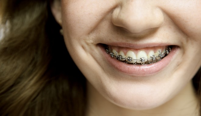 Δεν είναι τα δόντια σου πολύ μεγάλα – Το σαγόνι σου είναι πολύ μικρό