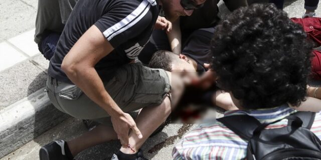 Φοιτητής ΑΠΘ: Η συγκλονιστική περιγραφή για το χτύπημα με κρότου λάμψης σε ευθεία βολή