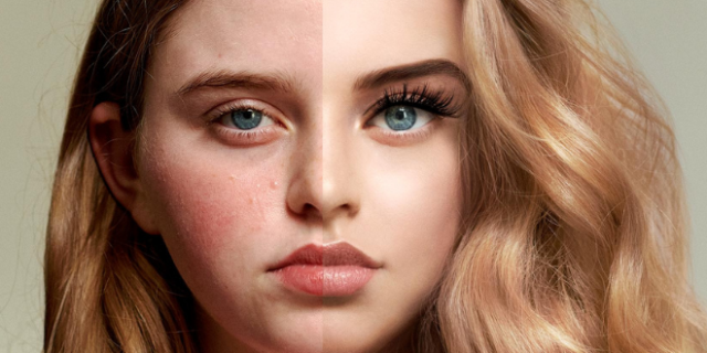 Selfie Self Esteem: Οι πιέσεις στα μέσα κοινωνικής δικτύωσης οδηγούν τα κορίτσια παγκοσμίως στο να διαστρεβλώνουν την εμφάνιση τους στο διαδίκτυο