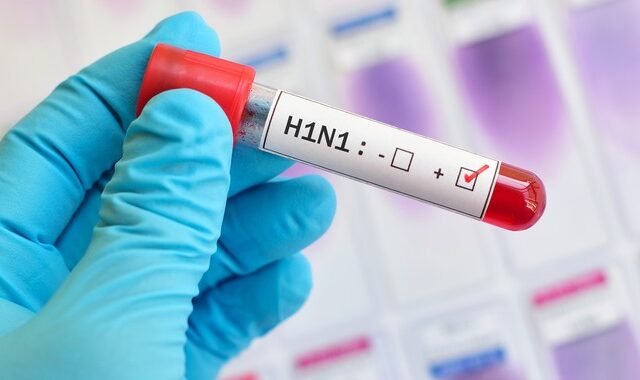 Έρευνα: “Απόγονος” της ισπανικής γρίπης του 1918 η H1N1 – Πώς προκύπτει η σχέση τους