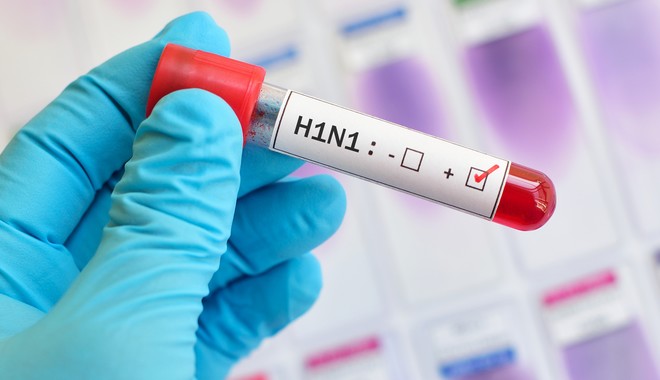 Έρευνα: “Απόγονος” της ισπανικής γρίπης του 1918 η H1N1 – Πώς προκύπτει η σχέση τους