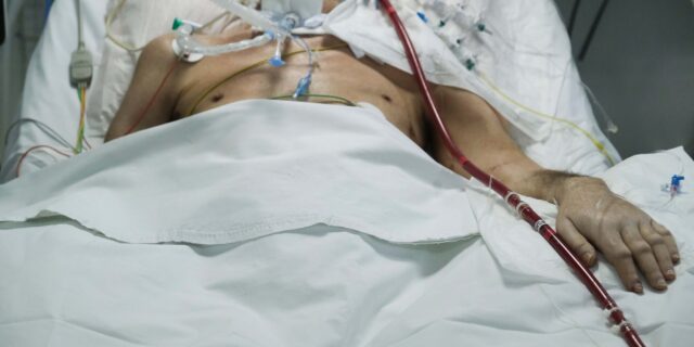 Κορονοϊός: Δραματική πρωτιά σε θανάτους έφερε στην Ελλάδα η Όμικρον