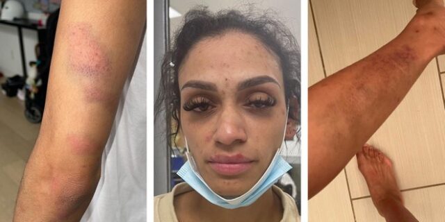 Σύζυγος παίκτη του ΝΒΑ καταγγέλλει ενδοοικογενειακή βία – “Δεν μπορώ να σιωπήσω άλλο”