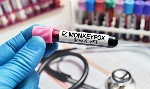 Ευλογιά των Πιθήκων: Τέλος η ονομασία “monkeypox” – Ρατσιστική η χρήση του όρου