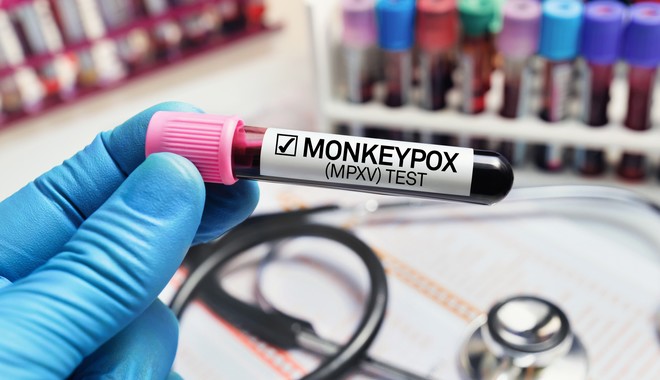 Ευλογιά των Πιθήκων: Τέλος η ονομασία “monkeypox” – Ρατσιστική η χρήση του όρου