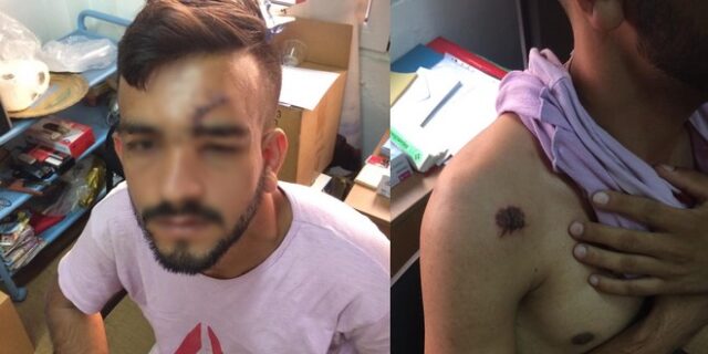 ΚΕΕΡΦΑ: Άγρια ρατσιστική επίθεση στην Πλατεία Αττικής κατά μετανάστη