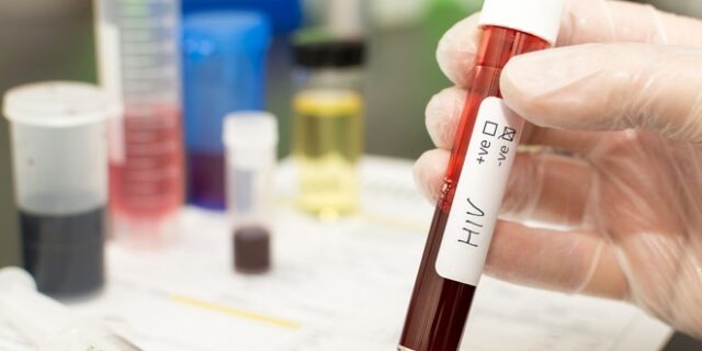 HIV: Θεραπεύτηκε ο γηραιότερος ασθενής ύστερα από μεταμόσχευση βλαστοκυττάρων