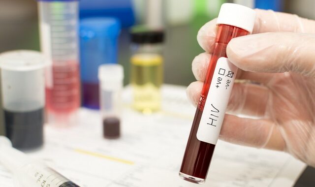HIV: Θεραπεύτηκε ο γηραιότερος ασθενής ύστερα από μεταμόσχευση βλαστοκυττάρων