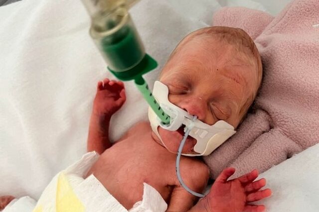 Κύπρος: Κοριτσάκι γεννήθηκε μόλις στις 25 εβδομάδες κύησης