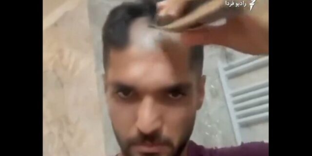 Ιρανός ποδοσφαιριστής ξύρισε το κεφάλι του για να στηρίξει τον αγώνα των γυναικών στη χώρα του