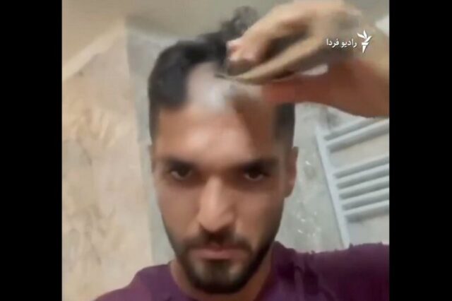 Ιρανός ποδοσφαιριστής ξύρισε το κεφάλι του για να στηρίξει τον αγώνα των γυναικών στη χώρα του