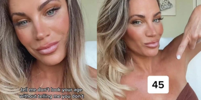 TikTok: 45χρονη κάνει μπότοξ για να φαίνεται νεότερη αλλά το κοινό της διαφωνεί – “Φαίνεσαι 50”