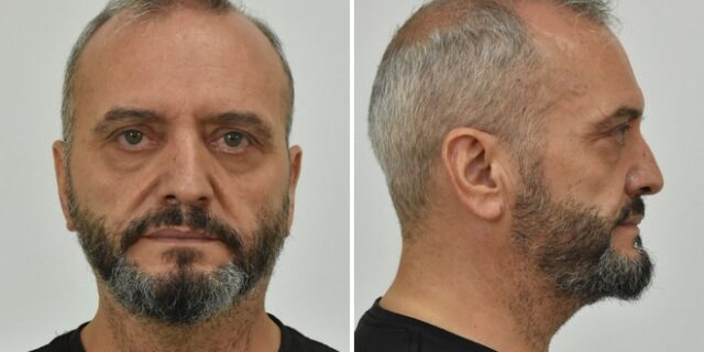 Κολωνός: Αναμένεται ένταλμα σύλληψης για συγγενή του Μίχου