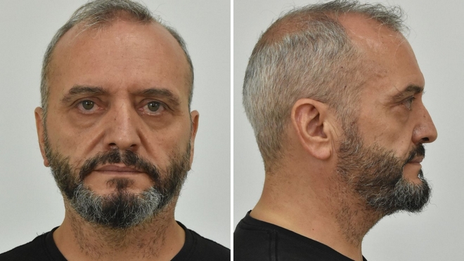 Κολωνός: Απολογούνται 53χρονος και 42χρονος – Οι κατηγορίες που αντιμετωπίζουν