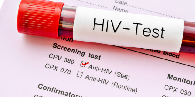 HIV/AIDS: Tα λιγότερα κρούσματα της εντεκαετίας καταγράφηκαν το 2022 – Έρχονται self test
