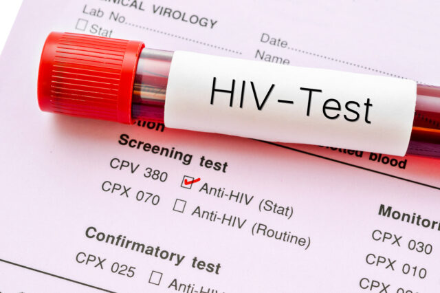 Έρχεται Εθνικό Μητρώο ασθενών με HIV και ηλεκτρονική συνταγογράφηση φαρμάκων