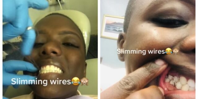 Ακραίο φαινόμενο στο TikTok: Έδεσε τα δόντια της με σιδεράκια για να χάσει βάρος