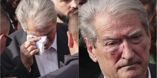 Αλβανία: Ο Μπερίσα γρονθοκοπήθηκε στο πρόσωπο από περαστικό – Η στιγμή της επίθεσης