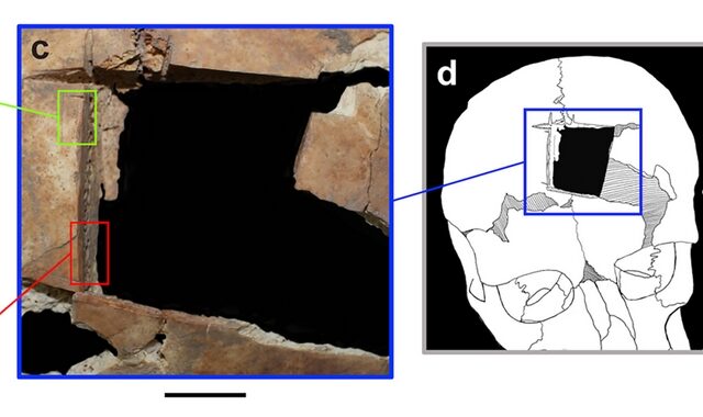 Αρχαιολόγοι ανακάλυψαν κρανίο με τετράγωνη τρύπα – Τι σημαίνει