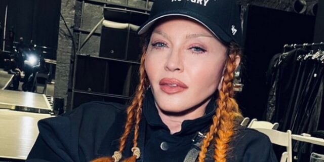 Madonna: Τρολάρει τους επικριτές της και ποζάρει μετά τον πλαστικό – “Κοιτάξτε πόσο χαριτωμένη είμαι”