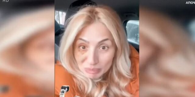 Μαρία Ηλιάκη: Επανήλθε στα social media με μαυρισμένο μάτι – “Από την πολλή αγάπη, μου έριξε κουτουλιά η Κατερινούλα”