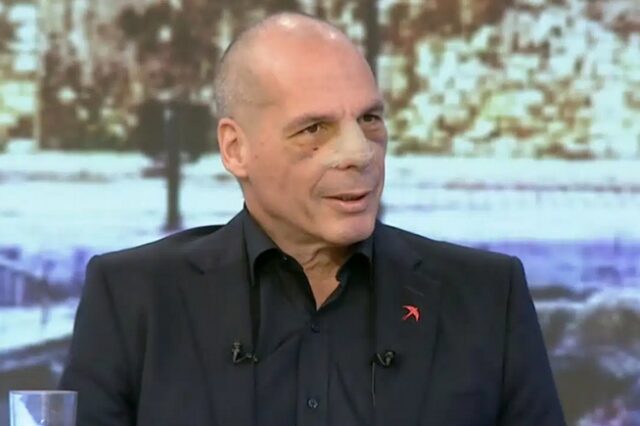 Γιάνης Βαρουφάκης: Η πρώτη εμφάνιση μετά τον ξυλοδαρμό στα Εξάρχεια