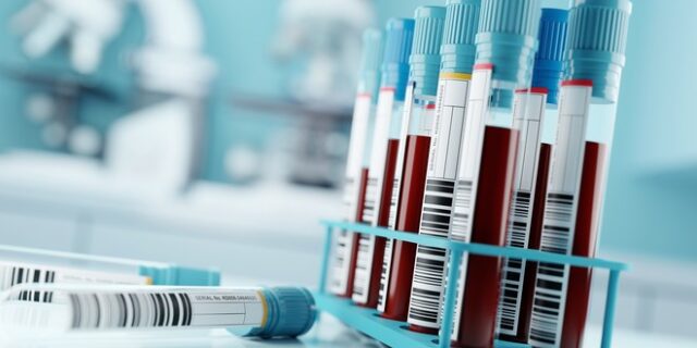 Σχεδόν 400 άνθρωποι ενημερώθηκαν λανθασμένα πως έχουν καρκίνο