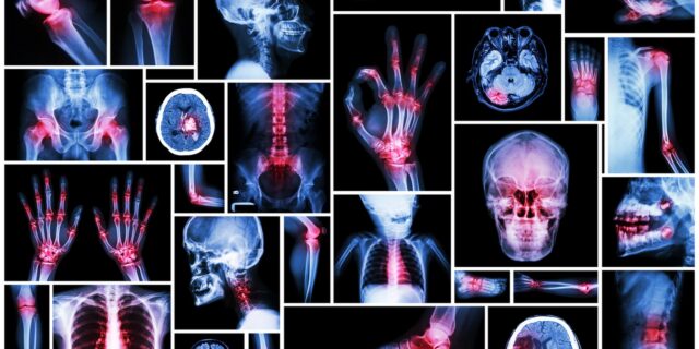 9 σημάδια που σου δείχνουν πως έχεις στο σώμα σου τον νέο μεγάλο εχθρό του