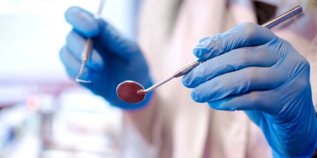 Βέλγιο: Αύξηση των περιπτώσεων “ψευτο-οδοντιάτρων” με πτυχίο από τη Ρουμανία