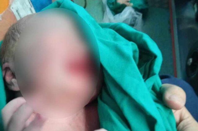 Φωτιά στην Αλεξανδρούπολη: Έγκυος γέννησε την ώρα της εκκένωσης του νοσοκομείου – Δείτε φωτογραφίες
