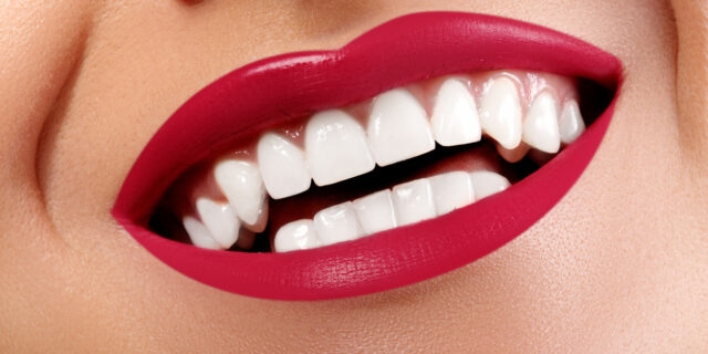 Πώς θα φτιάξεις τα τέλεια δόντια
