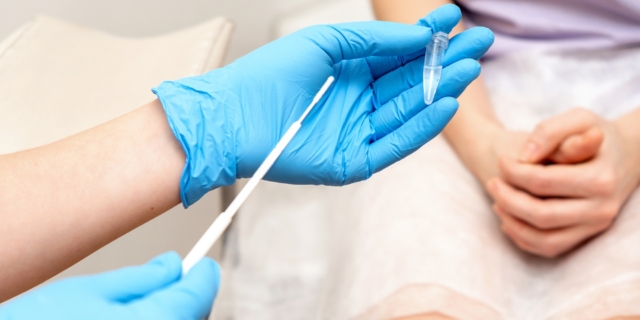 Γυναικολόγος λαμβάνει δείγμα για HPV DNA test