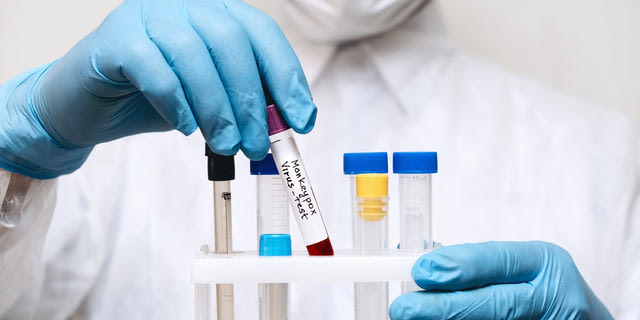 Φιαλίδια αίματος για εξέταση