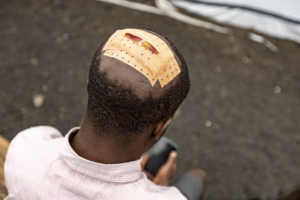 Τραυματίας που έχει δεχτεί φροντίδα από την ομάδα των Γιατρών Χωρίς Σύνορα.