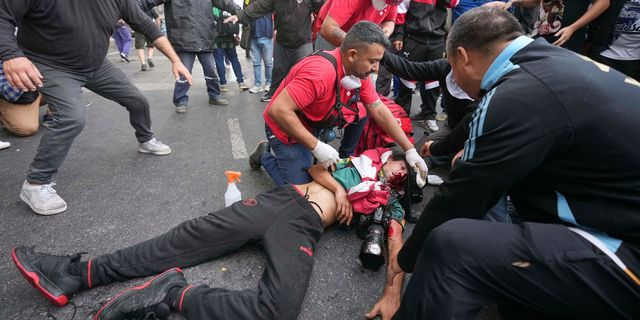 Οργή στην Αργεντινή: Φωτογράφος σε κώμα μετά από βίαιη καταστολή διαμαρτυρίας συνταξιούχων