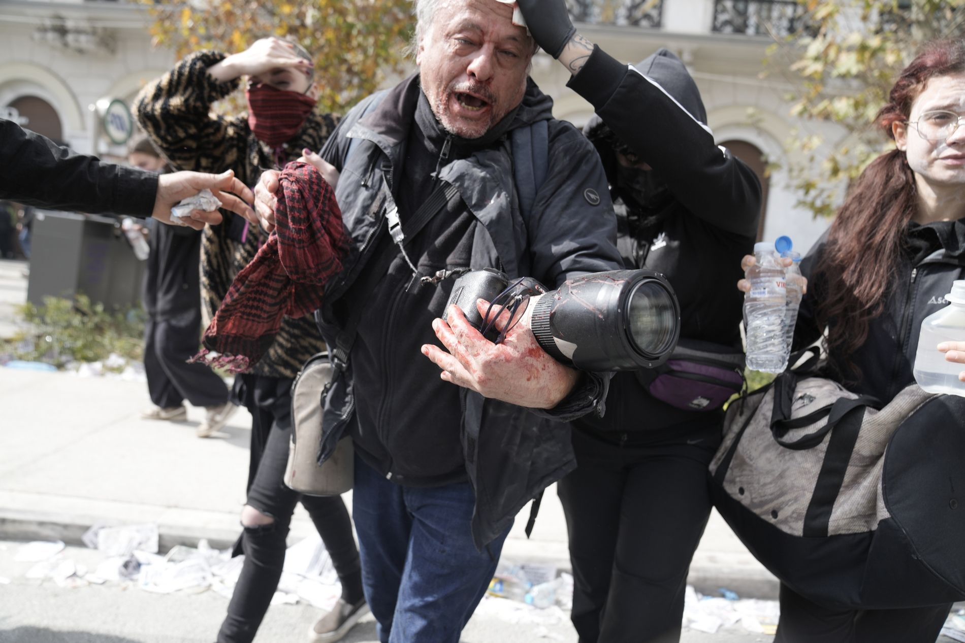 Ο φωτορεπόρτερ του ΑΠΕ-ΜΠΕ Ορέστης Παναγιώτου δέχεται βοήθεια μετά από χτύπημα στο κεφάλι, κατά τη διάρκεια επεισοδίων, στο συλλαλητήριο μνήμης με αφορμή τη συμπλήρωση δύο χρόνων από το σιδηροδρομικό δυστύχημα των Τεμπών που στοίχισε την ζωή σε 57 ανθρώπους, στην πλατεία 